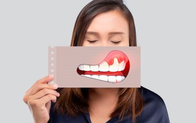 Encías inflamadas: causas y tratamientos para tu salud oral