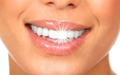 Blanqueamiento dental en Fuenlabrada: guía definitiva para una sonrisa radiante