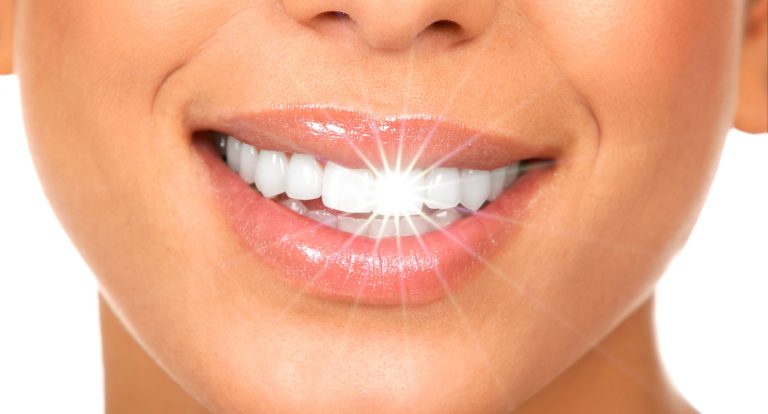 Blanqueamiento dental en Fuenlabrada