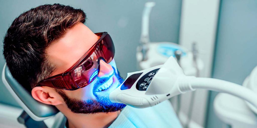 blanqueamiento dental en Móstoles