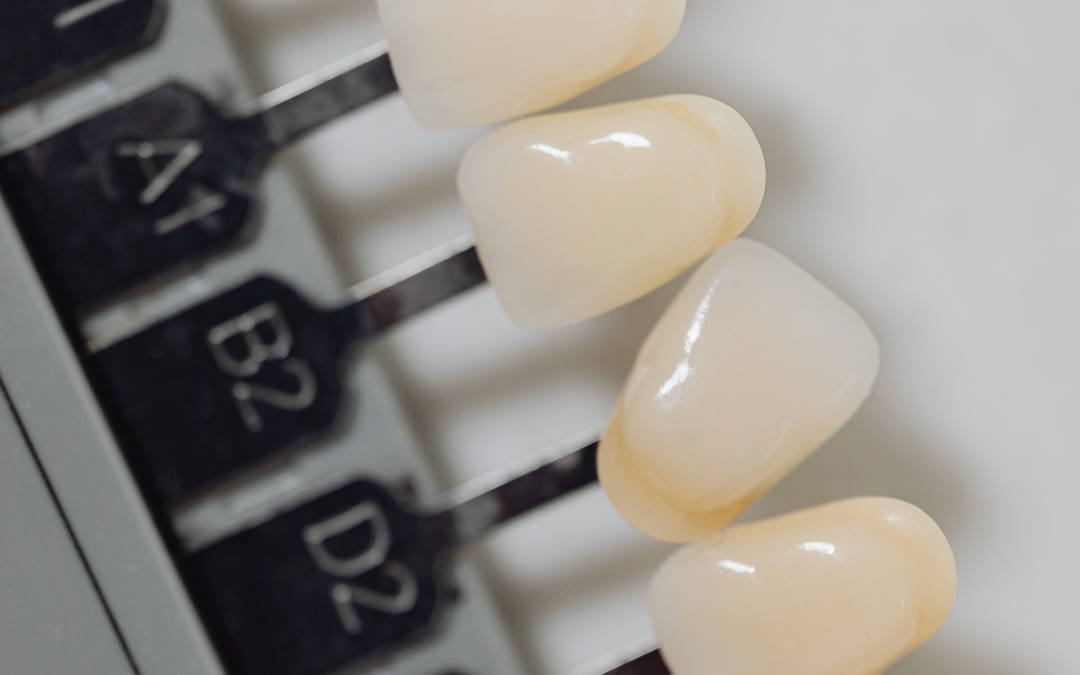 como mantener los dientes blancos