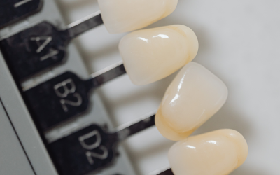 Cómo mantener los dientes blancos