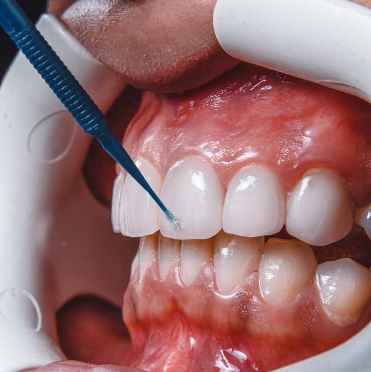 Grandental clinica dental