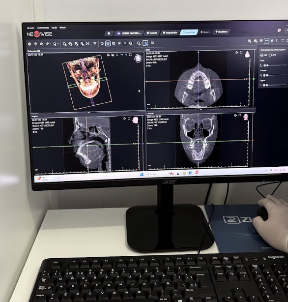 Nuevo escáner CBCT dental