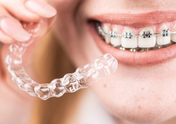 ortodoncia en Móstoles