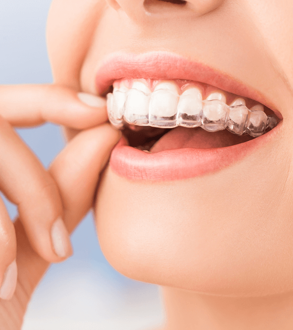 ortodoncia invisible fuenlabrada