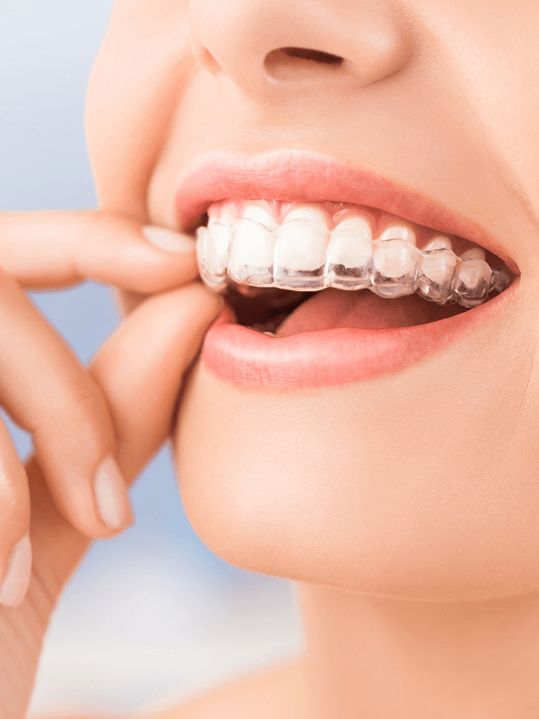 ortodoncia invisible fuenlabrada