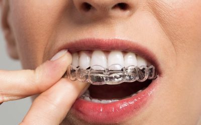 Invisalign en Fuenlabrada