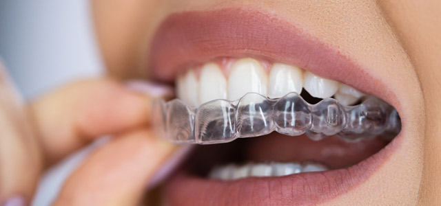 ortodoncia en Móstoles