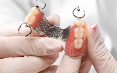 Prótesis dentales en Móstoles