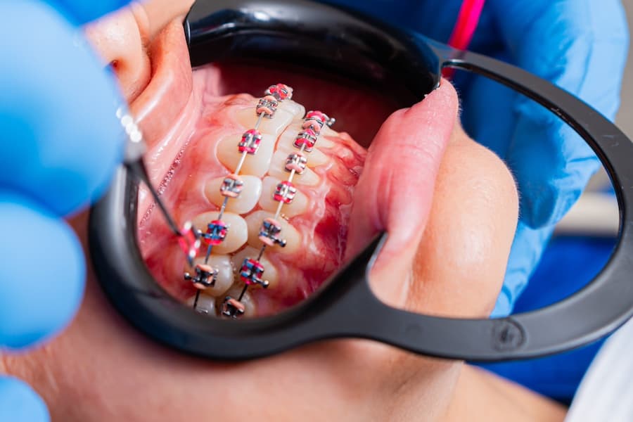 Ortodoncia en Fuenlabrada