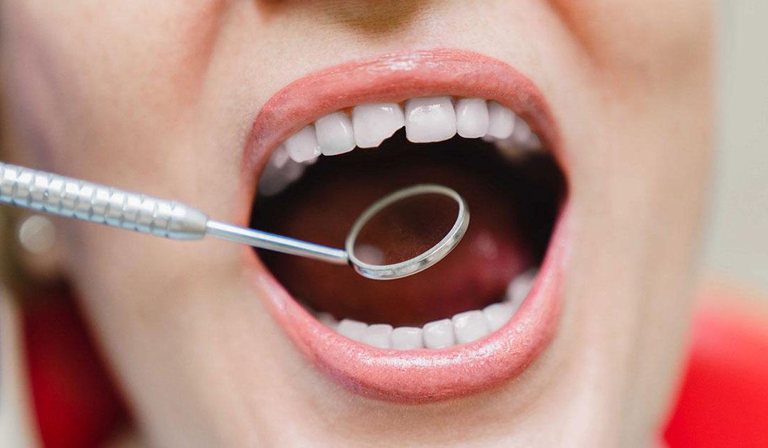 Reconstrucción dental en Fuenlabrada