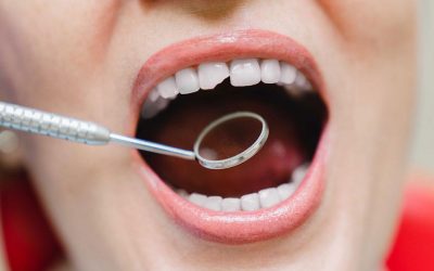 Reconstrucción dental en Fuenlabrada para recuperar la forma y función de tus dientes