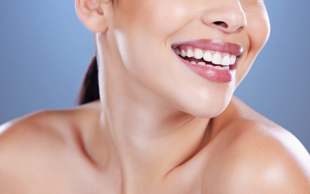 conseguir una sonrisa más estética