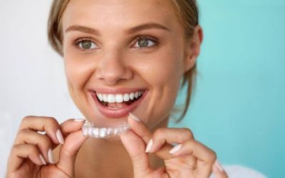 Tiempo de tratamiento Invisalign